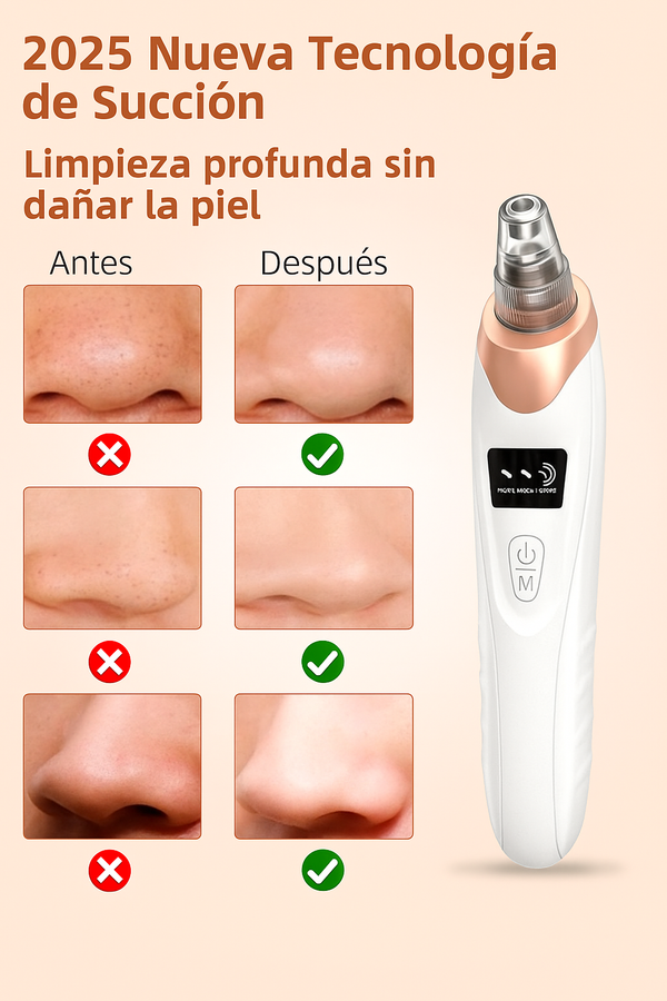 Aspiradora Removedor de Puntos Negros